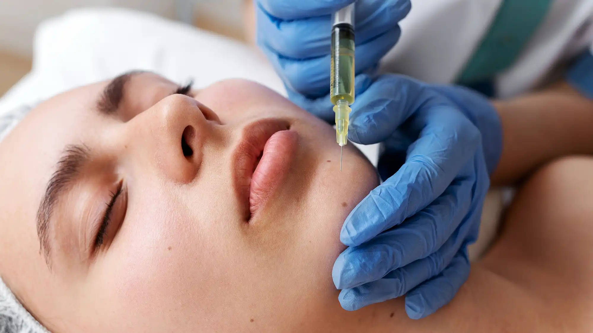 Polynucleotide Skin Booster Could Change Your Skin